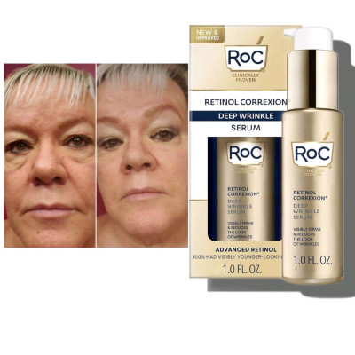 سرم تخصصی رتینول Roc-157300