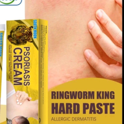 کرم ضدجوش بدن